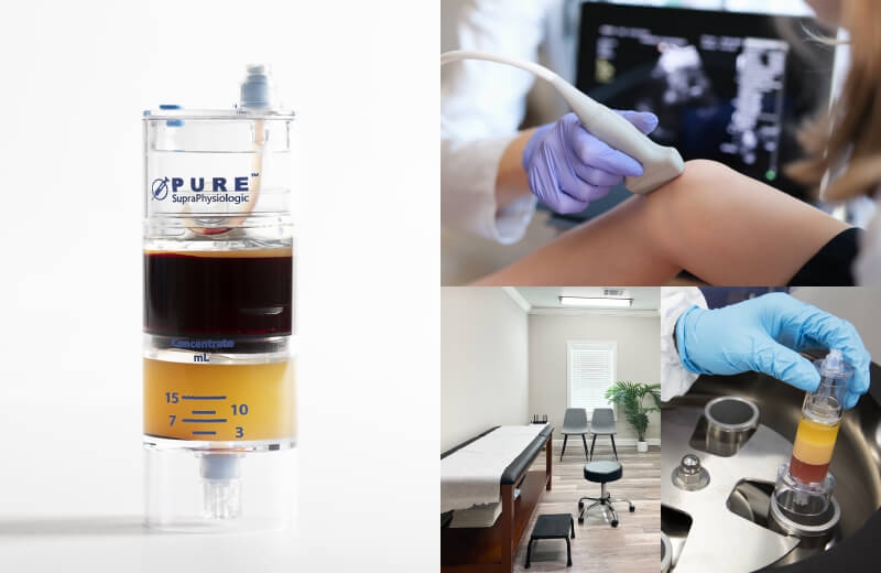 Gallery of images showing a platelet-rich plasma treatment, exam room, and ultrasound scan